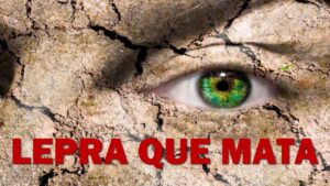 Portada del episodio LEPRA QUE MATA