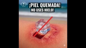 Portada del episodio Cómo Curar la Quemadura Solar: El Paso a Paso – Consejos Saludables (29-06-2022)