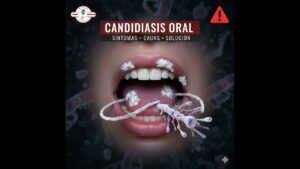 Portada del episodio Detén el crecimiento del hongo Cándida – Consejos Saludables (11-05-2022)